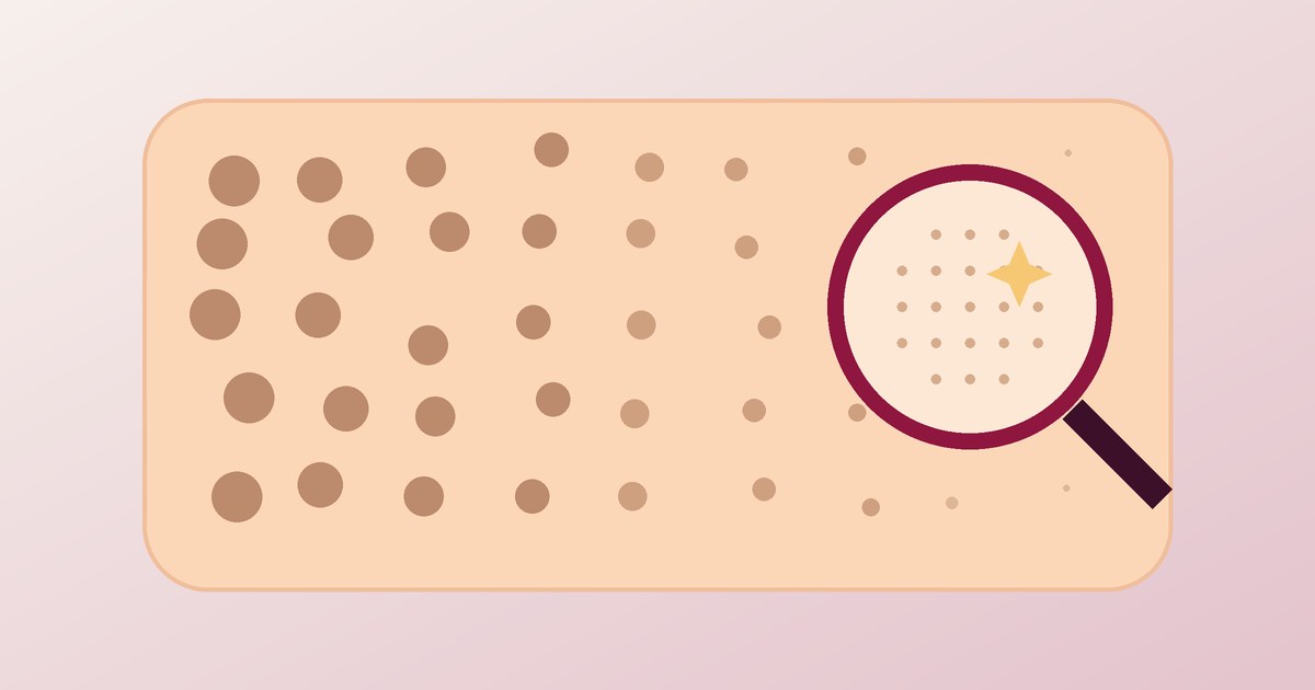 Open Pores on the Face: Why They Happen and What Actually Shrinks Them