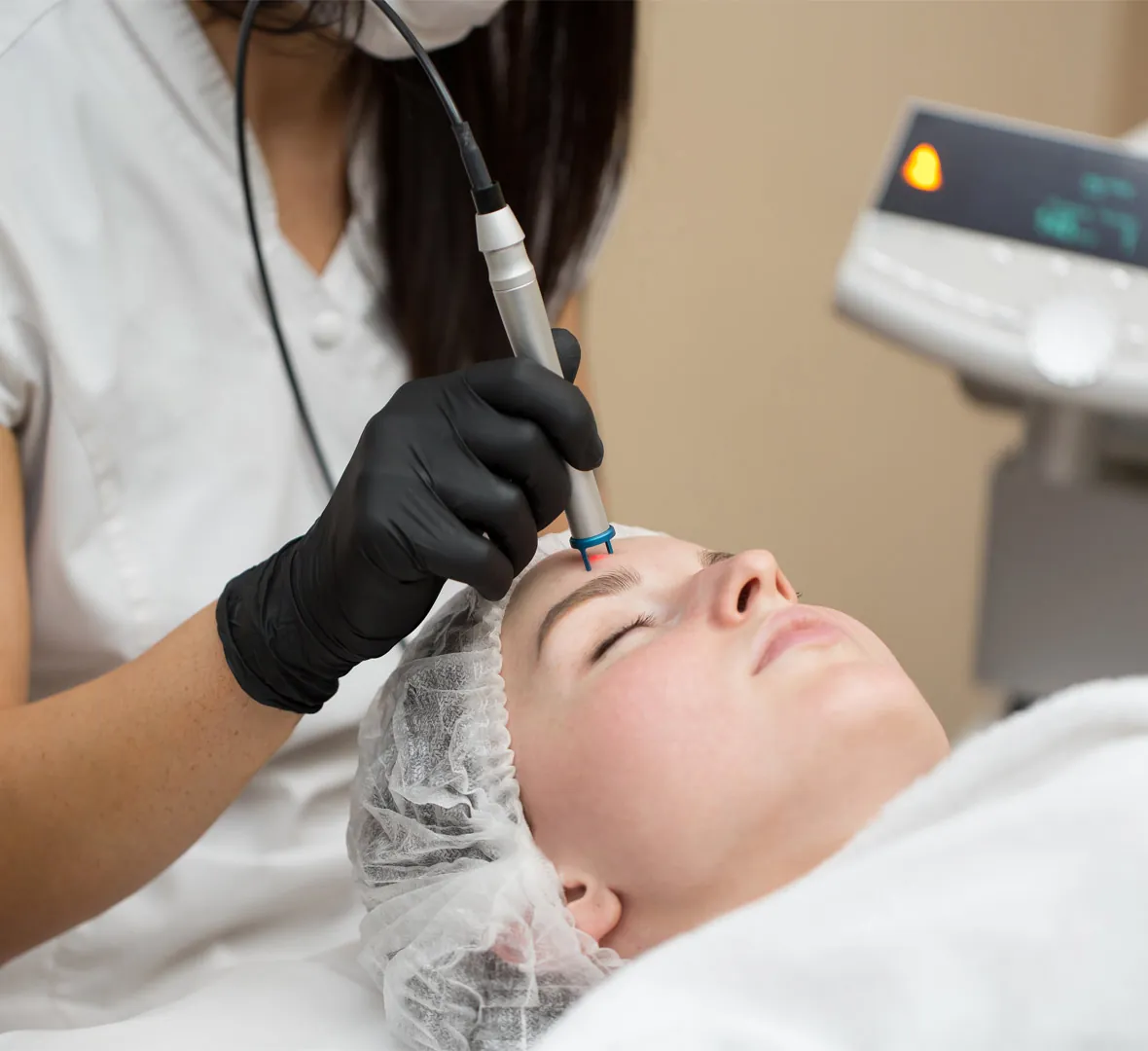 Acne and scar laser treatment at Dr. Thaj Clinic