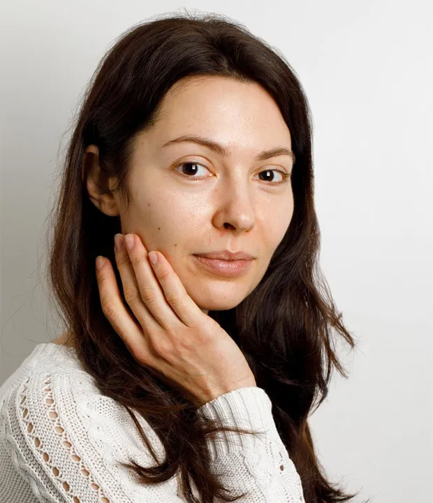 Before laser skin treatment – patient result at Dr. Thaj dermatologist clinic Kerala